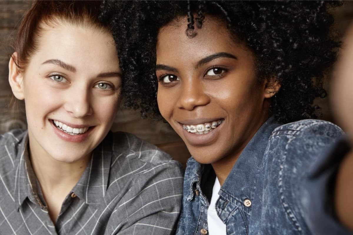 Seacoast Braces / Miller Orthodontics Now Exclusive Provider of Dynaflex Norris Passive Self-Ligating Brackets in Dover and Exeter, NH